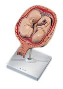 L10-7_01_5th-Month-Twin-Fetuses-Normal-Position.jpg